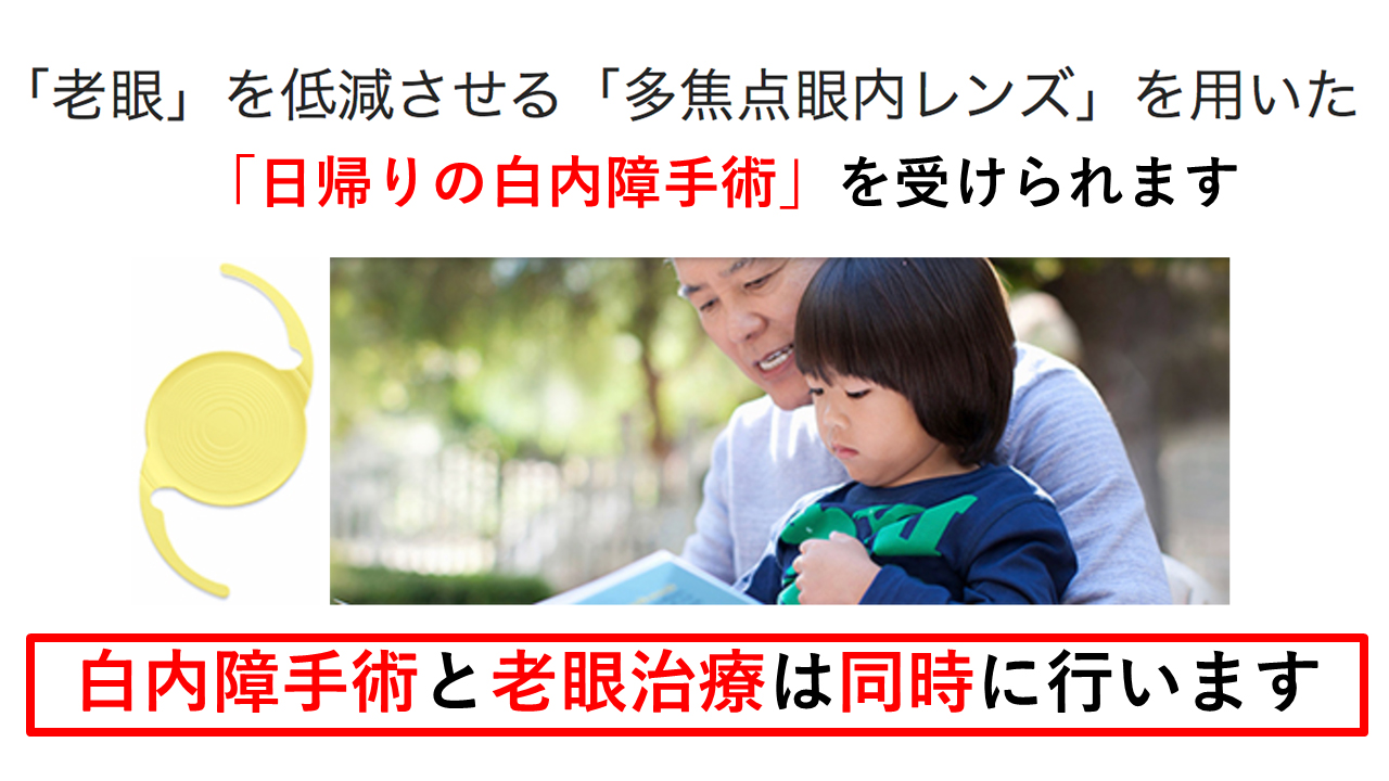 「老眼」を低減させる「多焦点眼内レンズ」を用いた「日帰りの白内障手術」を受けられます。白内障手術と老眼治療は同時に行います